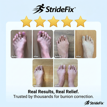 2X StrideFix™ Bunion Corrector