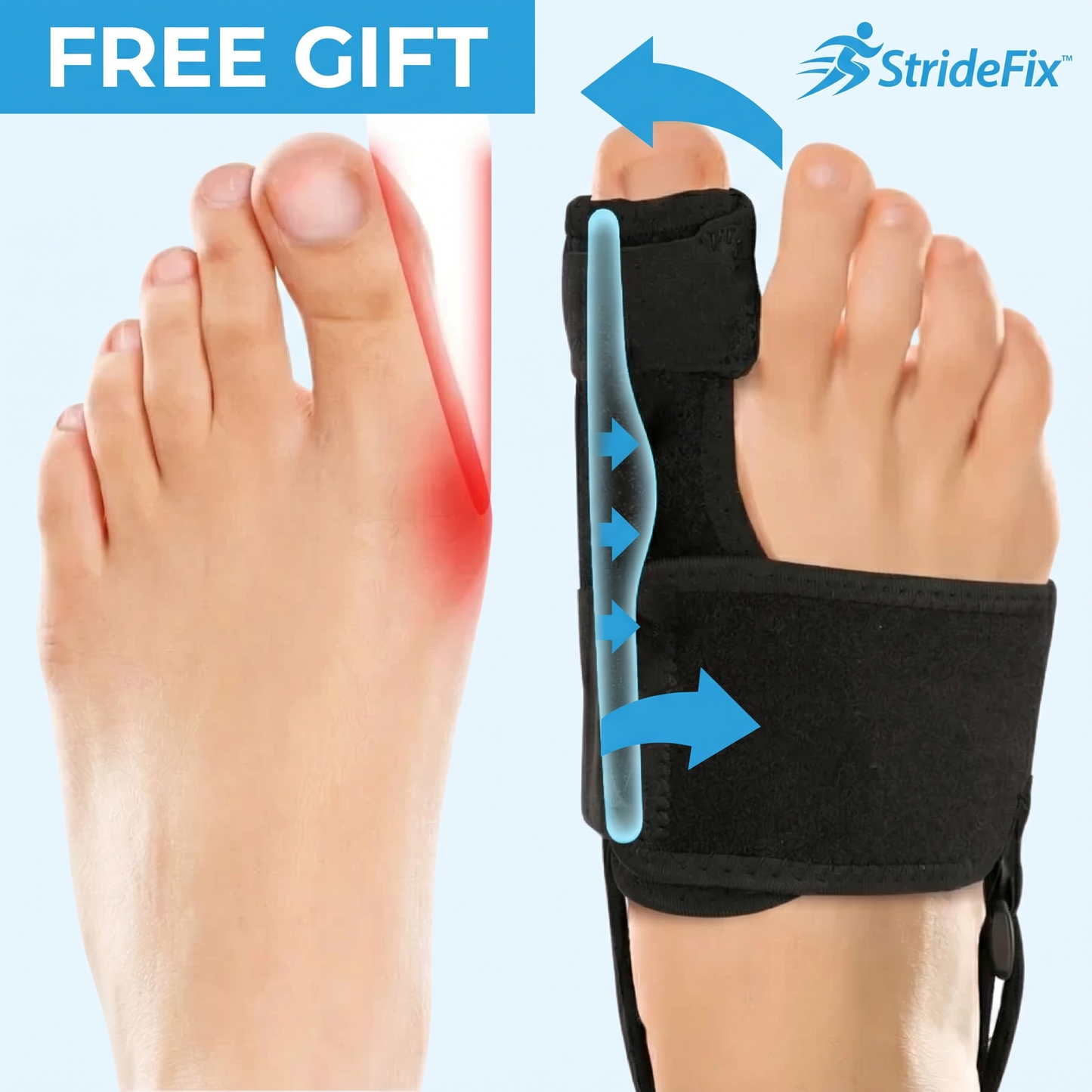 2X StrideFix™ Bunion Corrector